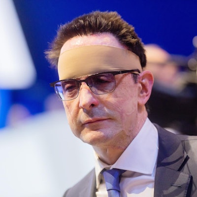 Innog y Bernhardt Günther