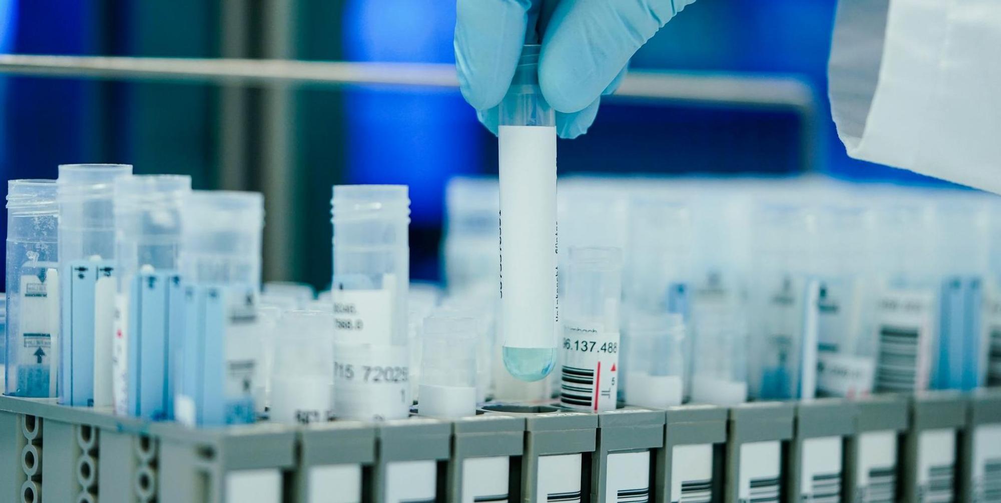 PCR-Test 190122