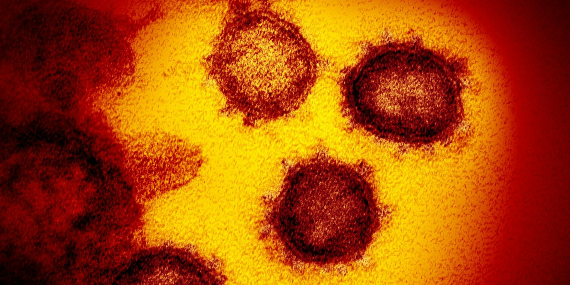 Coronavirus_Symbol