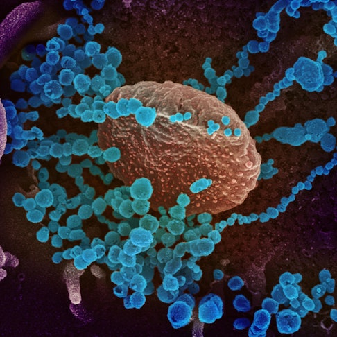 20200303coronavirus-005