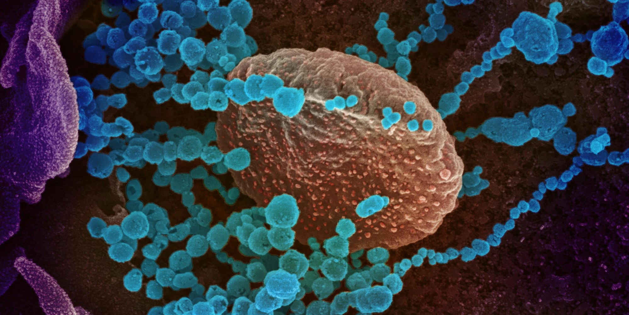 20200303coronavirus-005