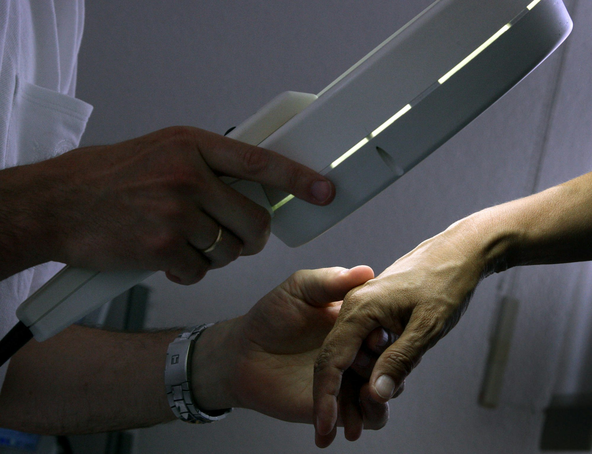 Hautkrebs-Screening beim Arzt