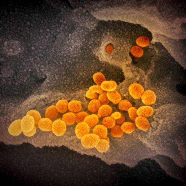 Coronavirus unter dem Mikroskop