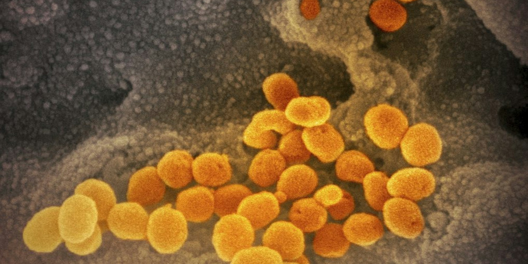 Coronavirus unter dem Mikroskop