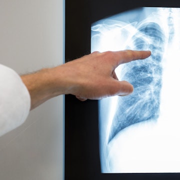 Lunge Symbolbild 060122