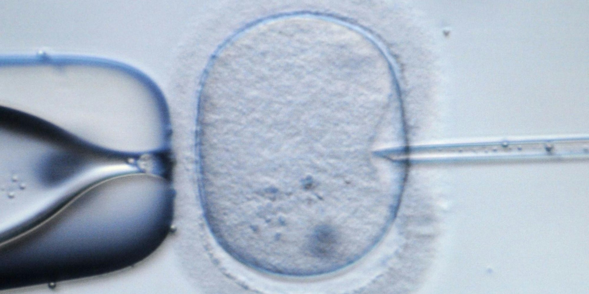 Embryo