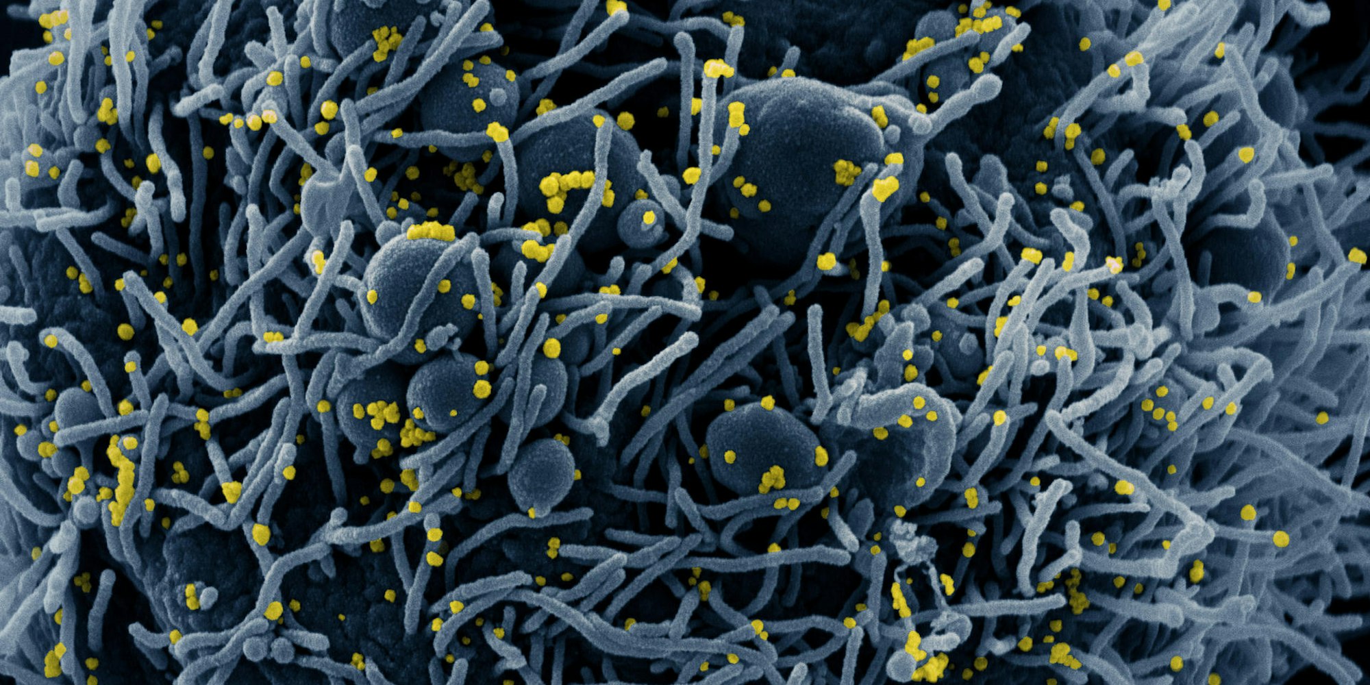 Corona BA.4 BA.5 Symbol DPA 130422