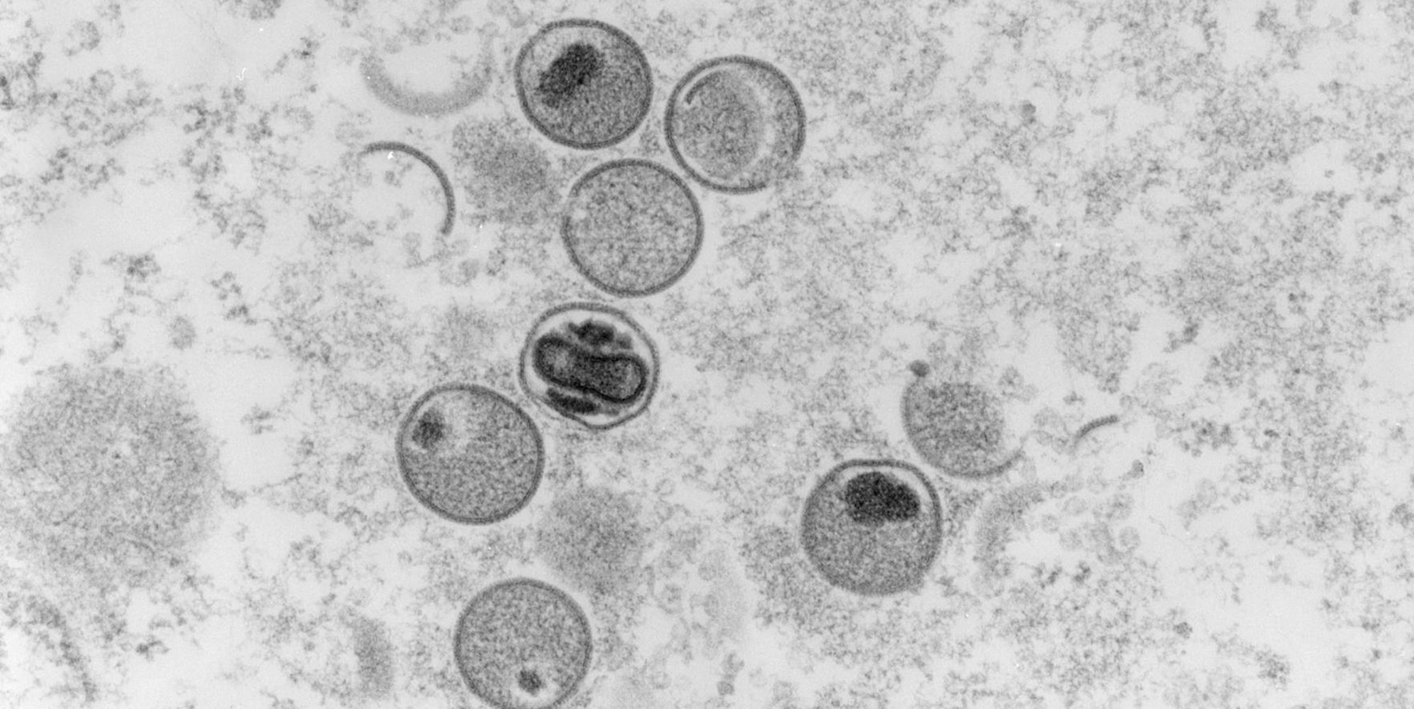 Affenpocken Symbolbild 310522