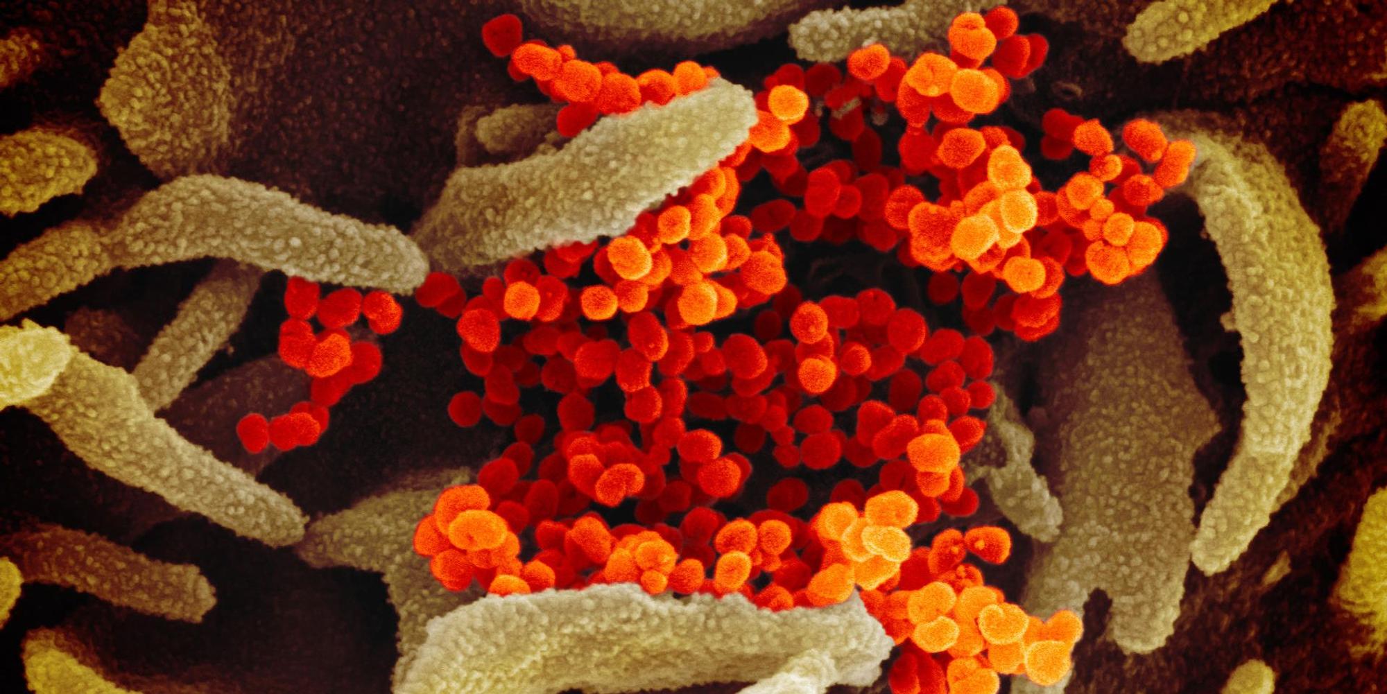 coronavirus