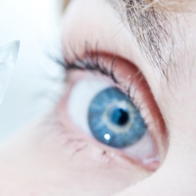 Frau_traegt_Kontaktlinsen