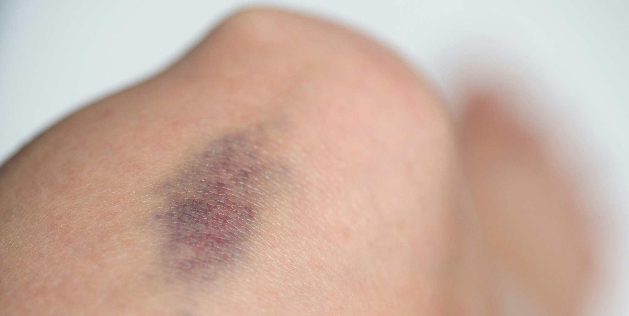 Wenn_das_Blut_kaum_z_51869587