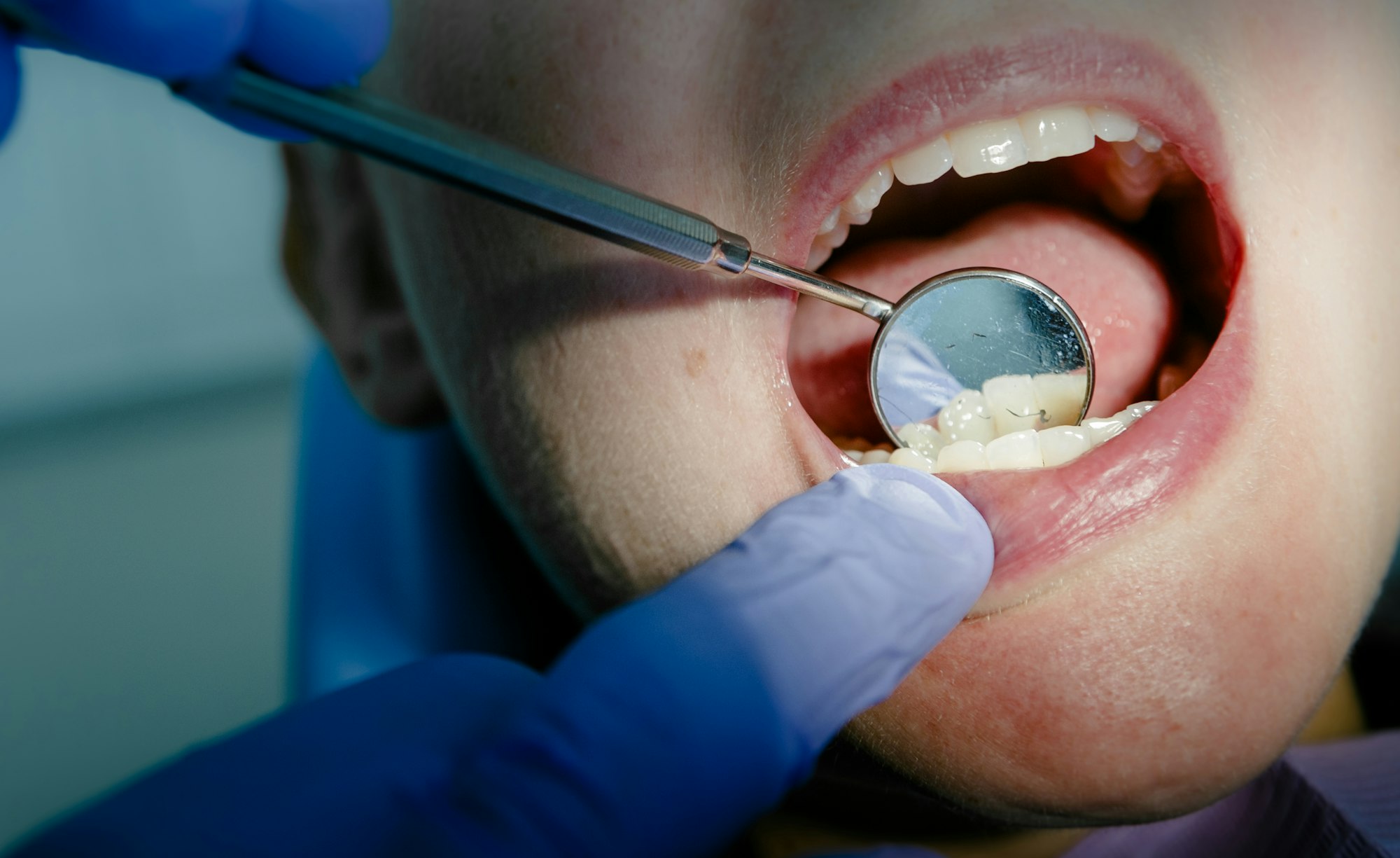 Zahngesundheit_Zahnarzt_Kontrolle