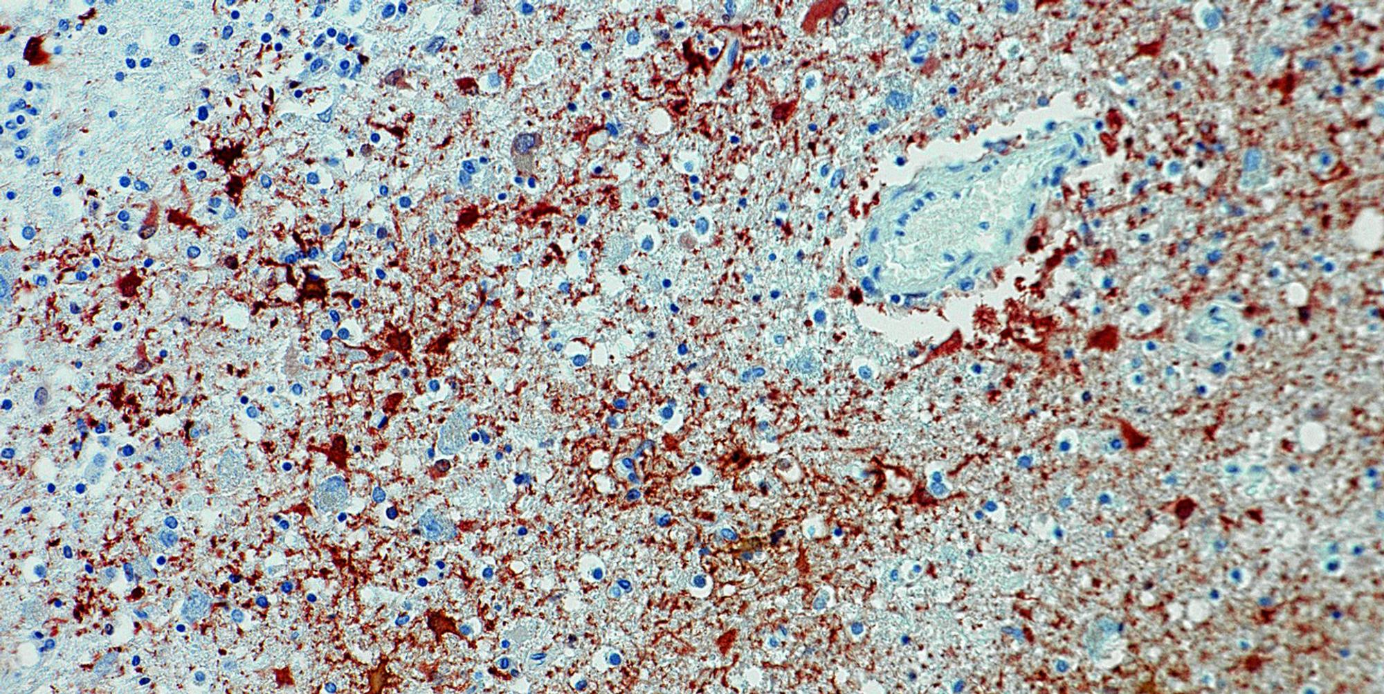 Borna-Virus DPA 080622