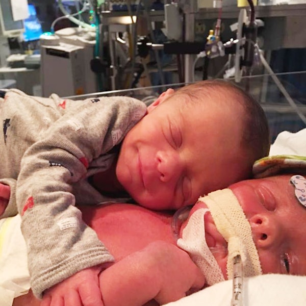 Zwillinge umarmen sich