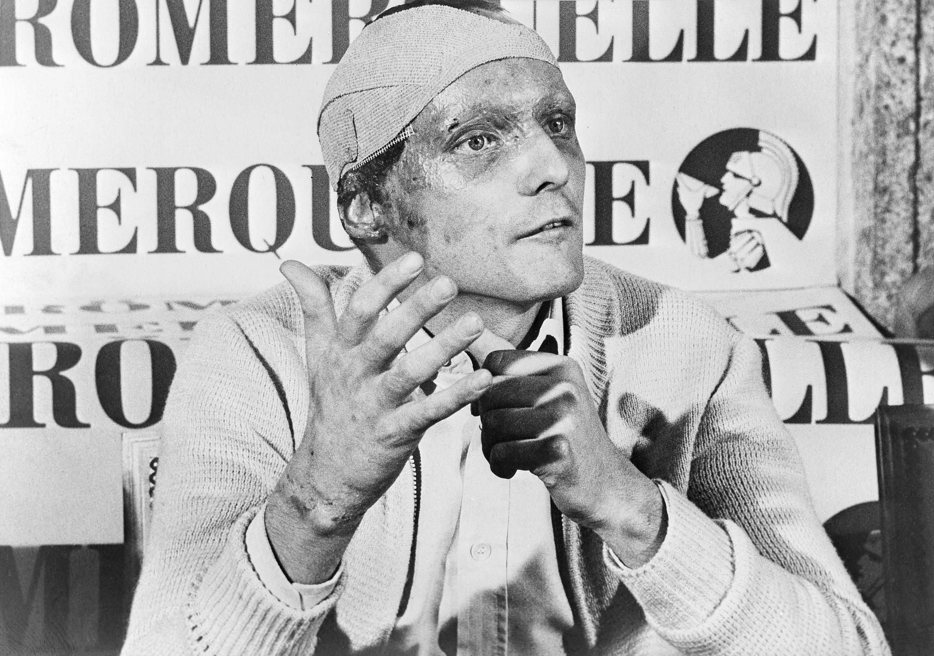 Lauda nach Unfall