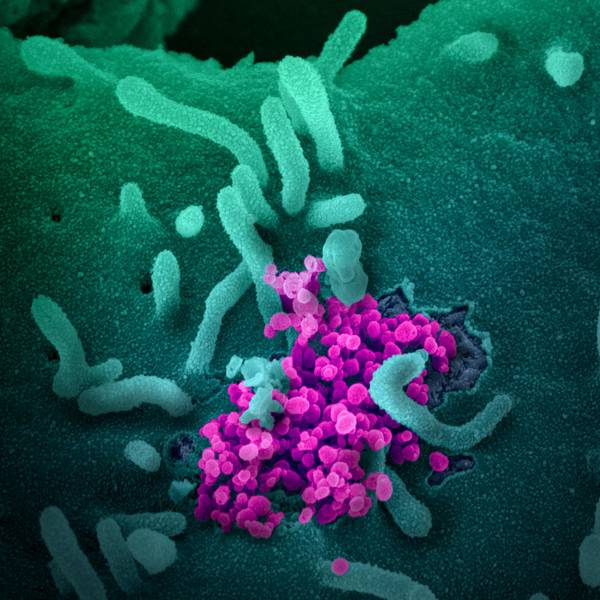 20200303coronavirus-006