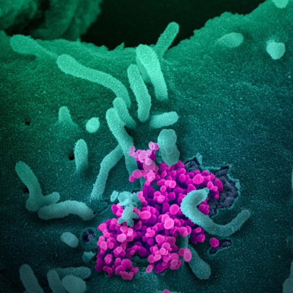 20200303coronavirus-006