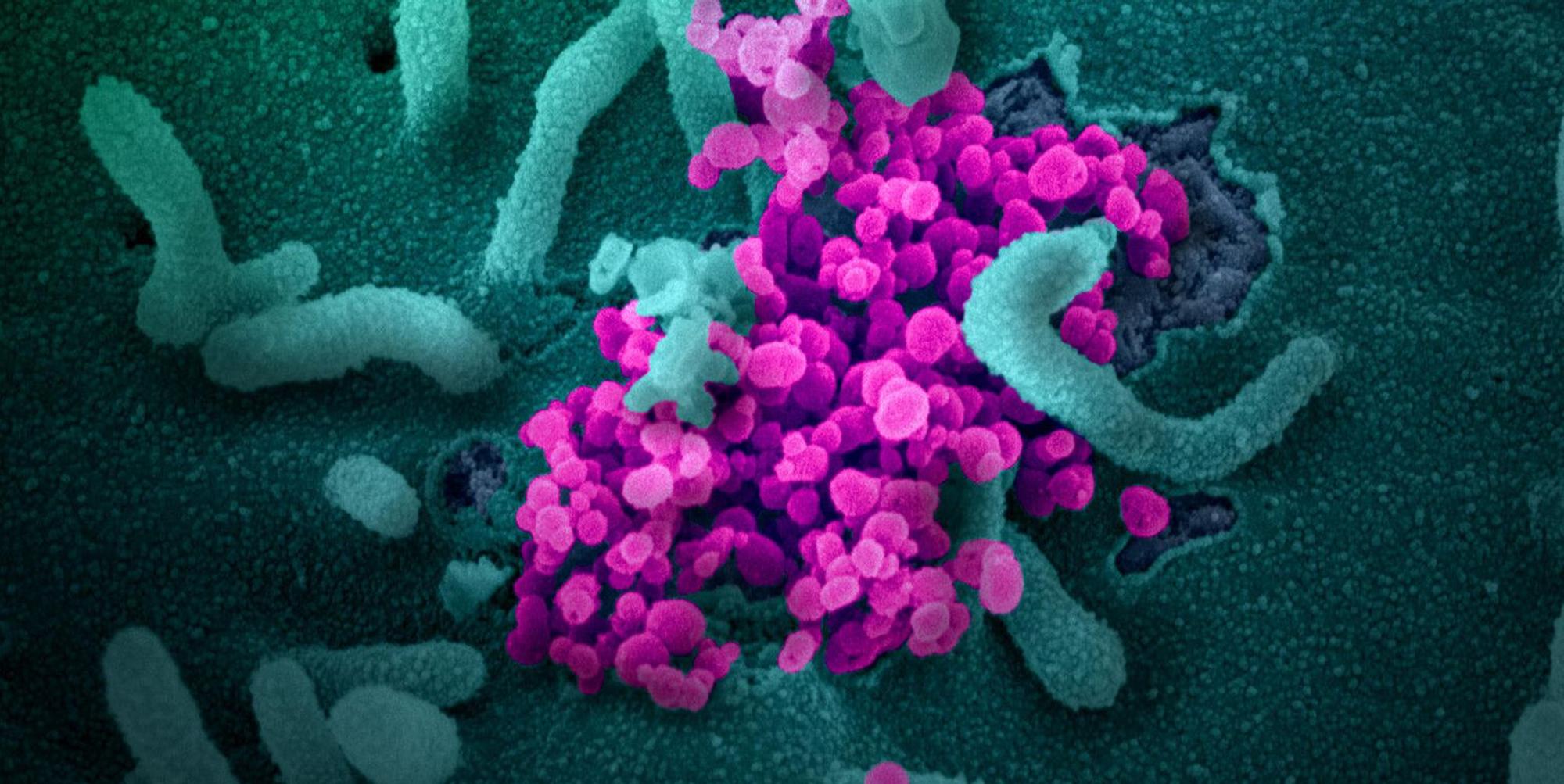 20200303coronavirus-006