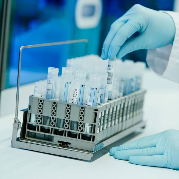 PCR Test Labor