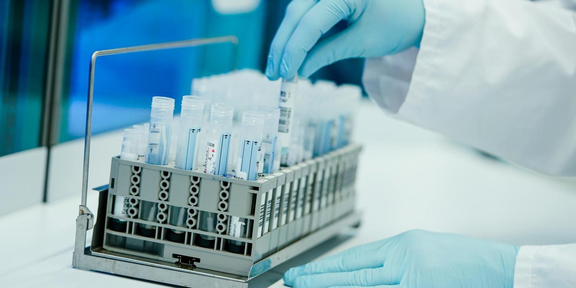 PCR Test Labor