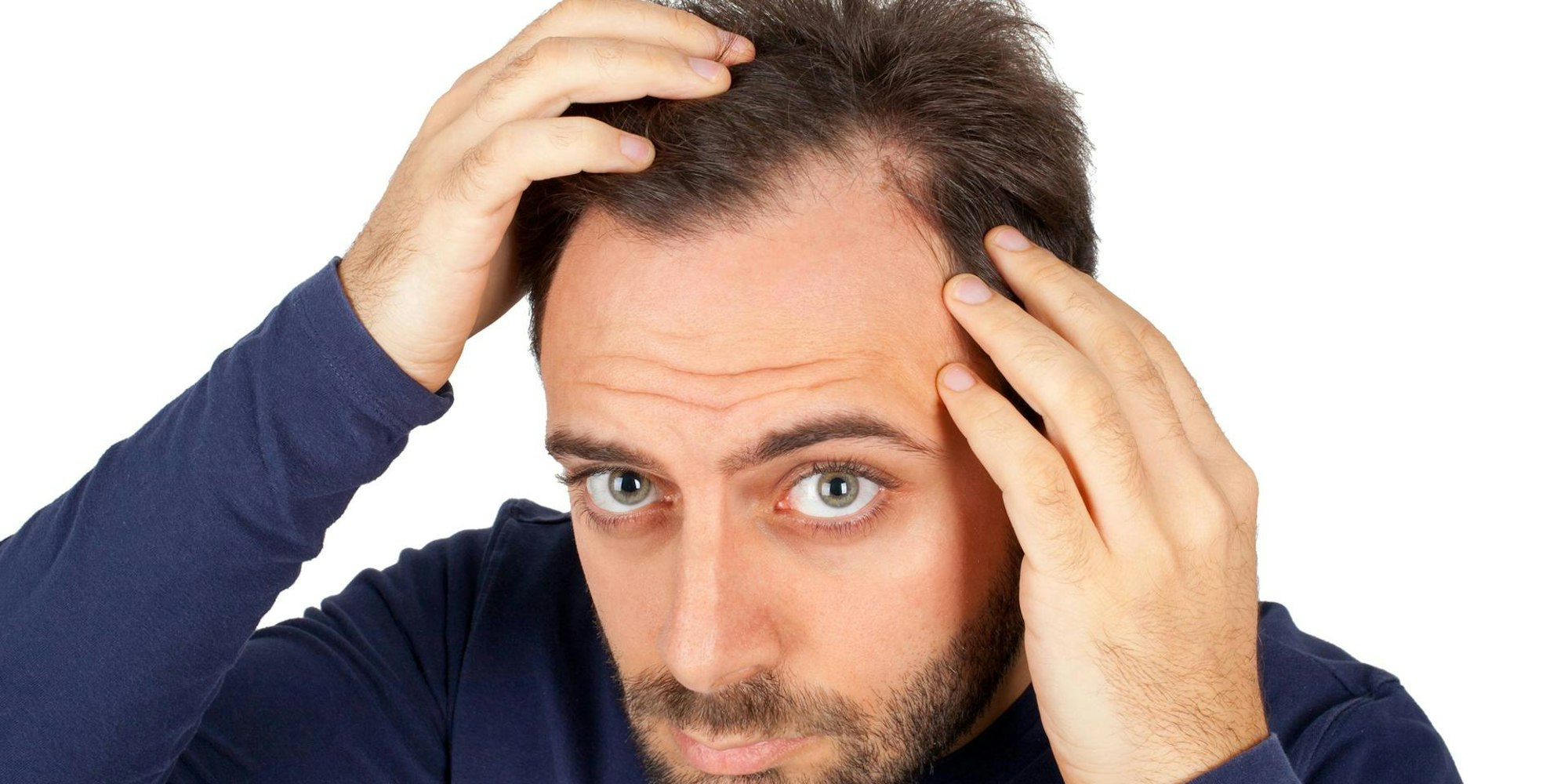 Haarausfall_Header_imago