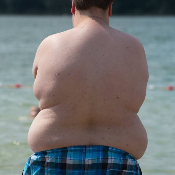 Übergewicht_Symbol