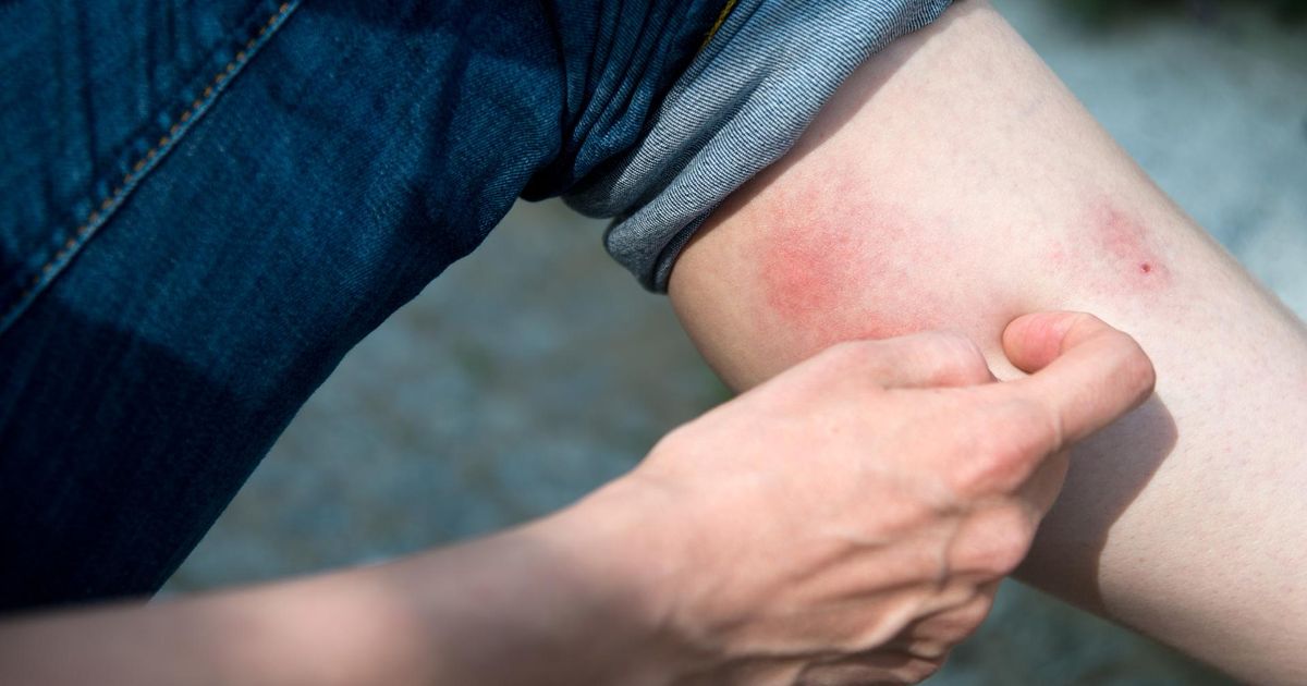 krankenkasse-warnt-immer-h-ufiger-schwere-entz-ndungen-durch