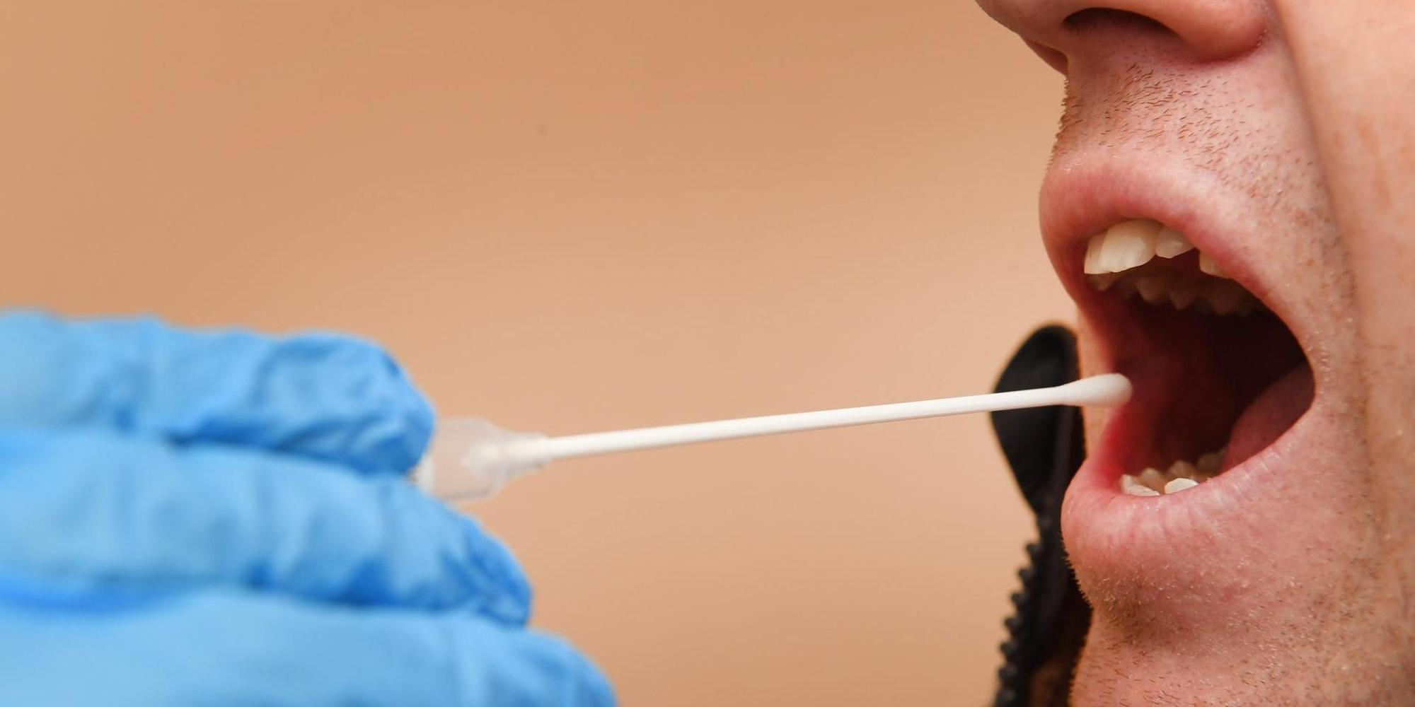 DNA-Test