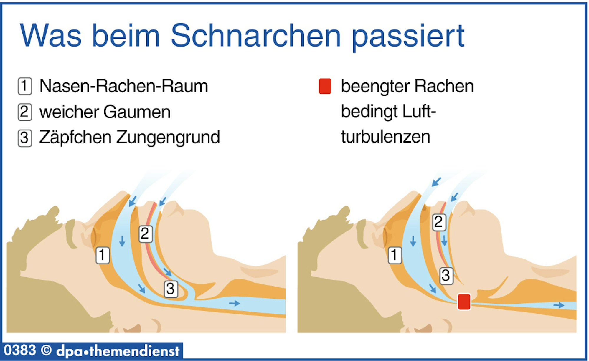 Was_beim_Schnarchen_28159055