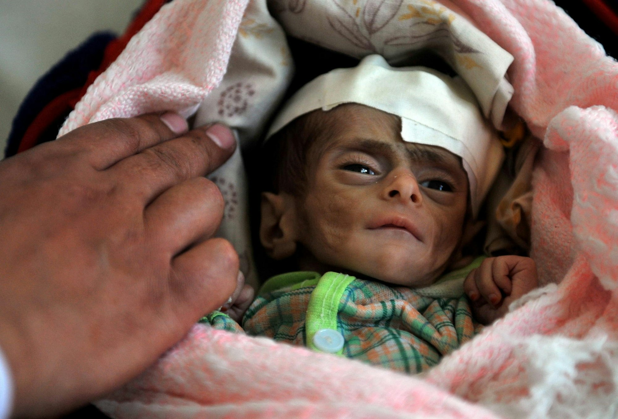 hungerndes-baby-afrika