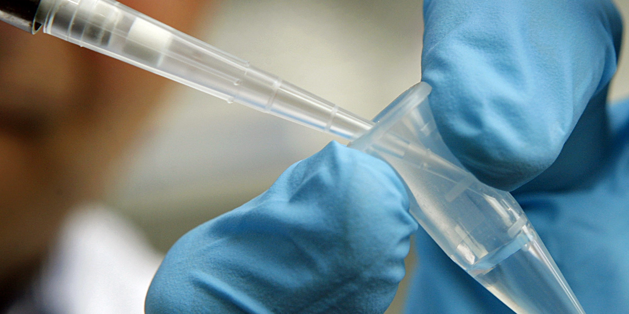 DNA_Probe_32931150