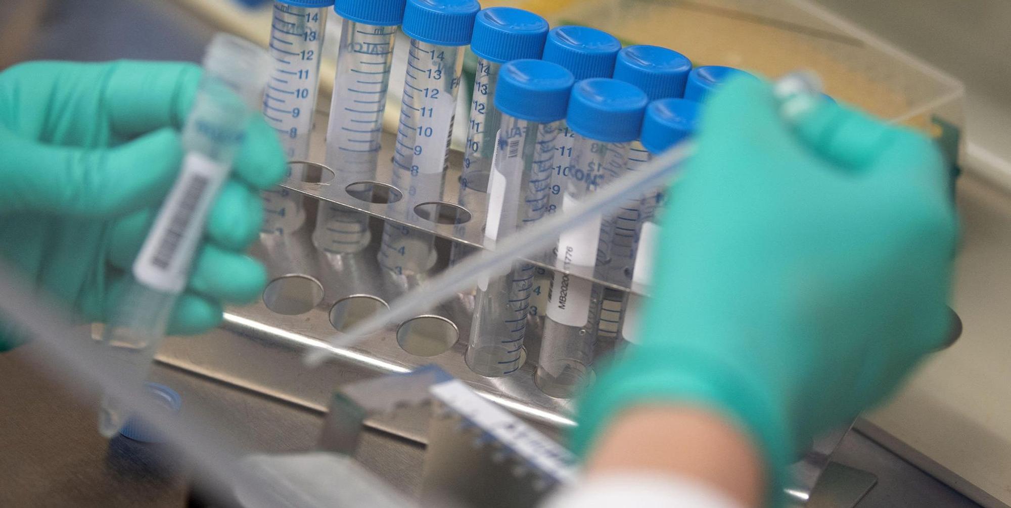Coronatest (1)