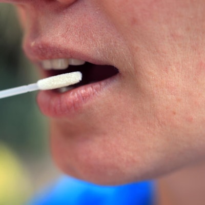 Das Foto zeigt einen offenen Mund und ein Wattestäbchen für einen Abstrich.