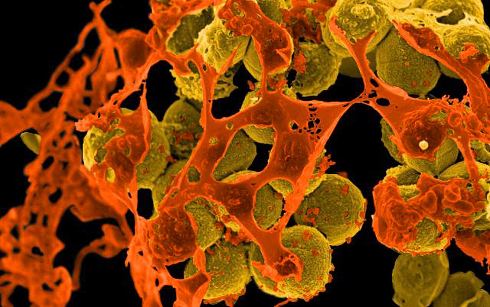 REM infektionen antibiotkika helfen nicht