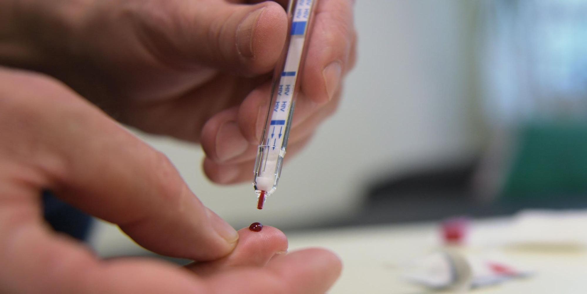 HIV Selbsttest