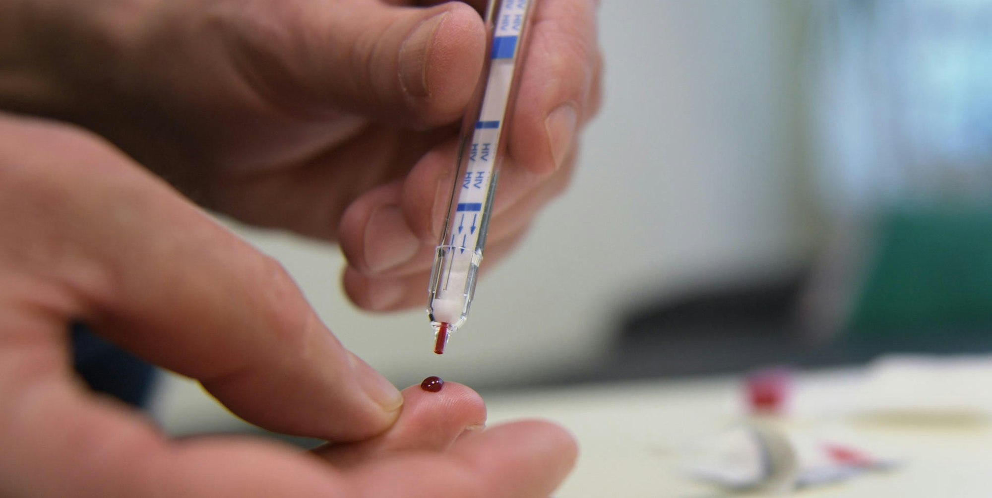 HIV Selbsttest