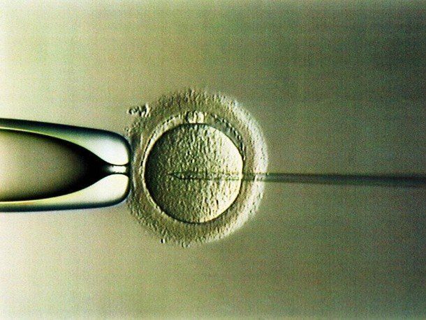 In-vitro-Diskussion in Polen: Kann knstliche Befruchtung eine schwere  Snde sein? - Rundschau Online