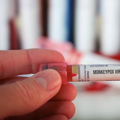 Affenpocken IMAGO 300522